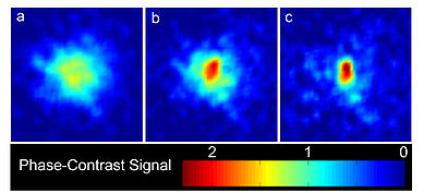 Phase-contrast images of 4He* in 1 ms TOF, showing BEC formation.  (a) a thermal cloud slightly above Tc.  (b) onset of BEC. (c) a nearly pure BEC after further evaporative cooling.